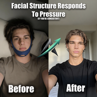 Front Loader™ Ascend Bundle